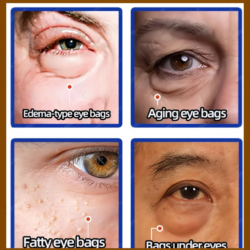 Creme de ação rápida para remoção de bolsas nos olhos, colágeno, antirrugas, firmeza, suaviza linhas finas, remoção de olheiras, bolsas nos olhos, clareamento, cuidados com os olhos